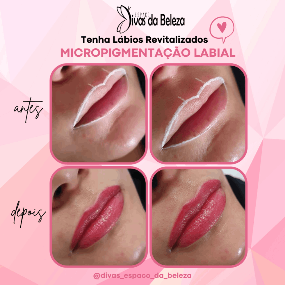 A revitalização visa restaurar a pele labial, colorindo e revitalizando o contorno da boca por meio da aplicação de nano pigmento.