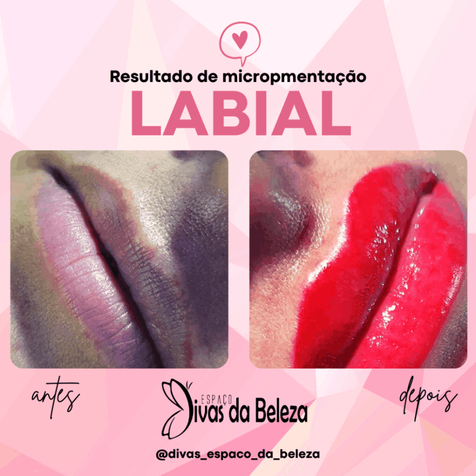 A micropigmentação labial pode ser a solução para quem deseja uma boca com mais cor e volume.